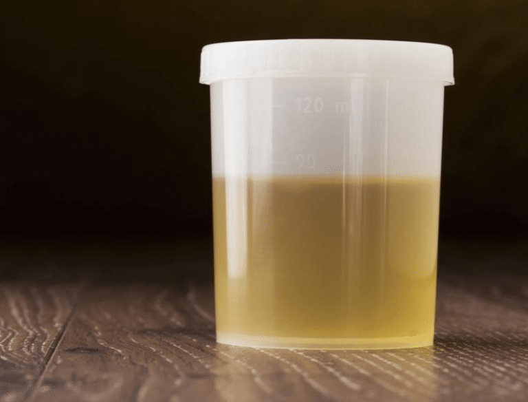 Foods That Cause Cloudy Urine
